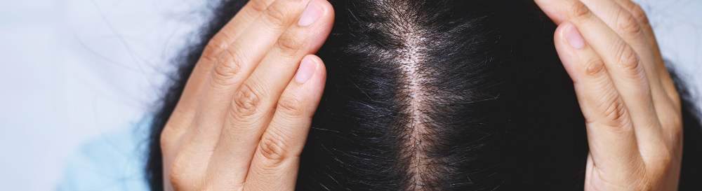 Como fortalecer o couro cabeludo e estimular o crescimento